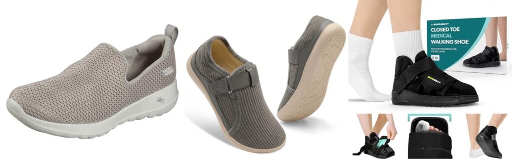 Shoes After Foot Surgery combined image